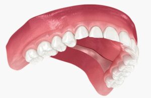 Mobilna proteza Split