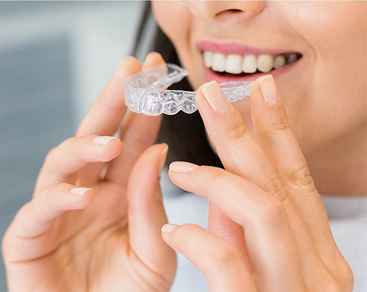 Invisalign sistem Split